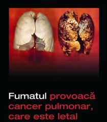 Galerie foto: Pictogramele de pe pachetele de tutun