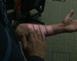 Skinput
