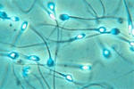 Un nou contraceptiv non-hormonal