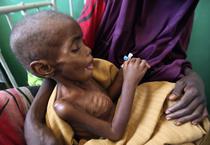 Foametea din Somalia
