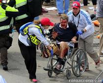 Un barbat cu piciorul sfartecat de explozie - Boston