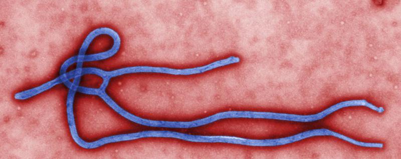 virusul Ebola