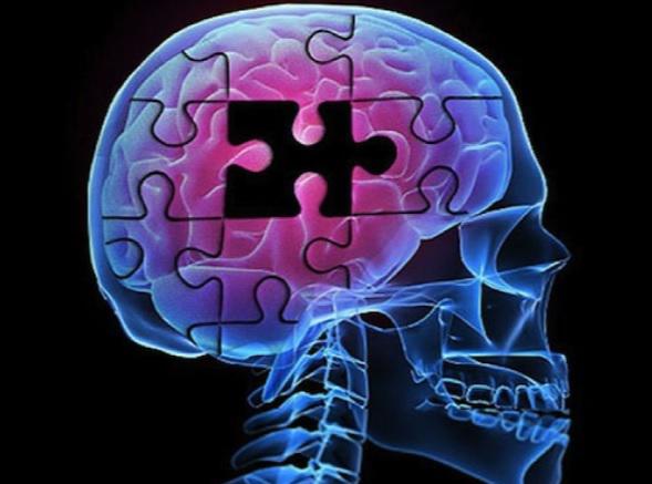 Cum se degenereaza neuronii in urma leziunilor traumatice craniocerebrale