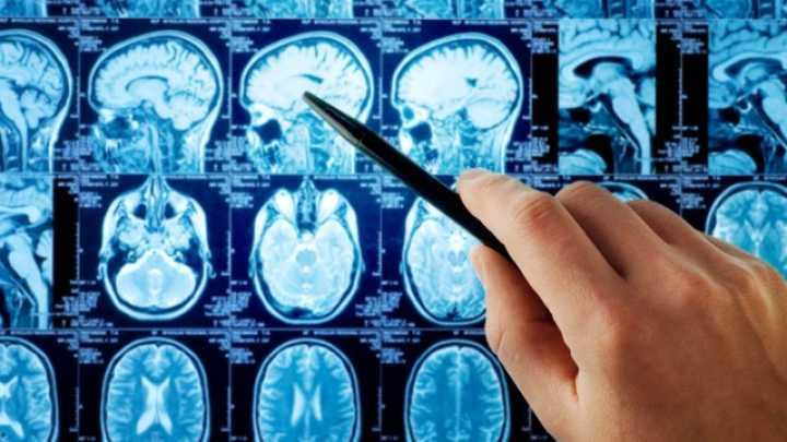 Nivelul ridicat de inflamatie in creier si aparitia gandurilor suicidale