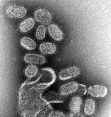 Virusul gripei, marit de 100.000 de ori