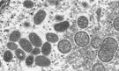 Virusul variolei maimuței suferă mutații neobișnuite