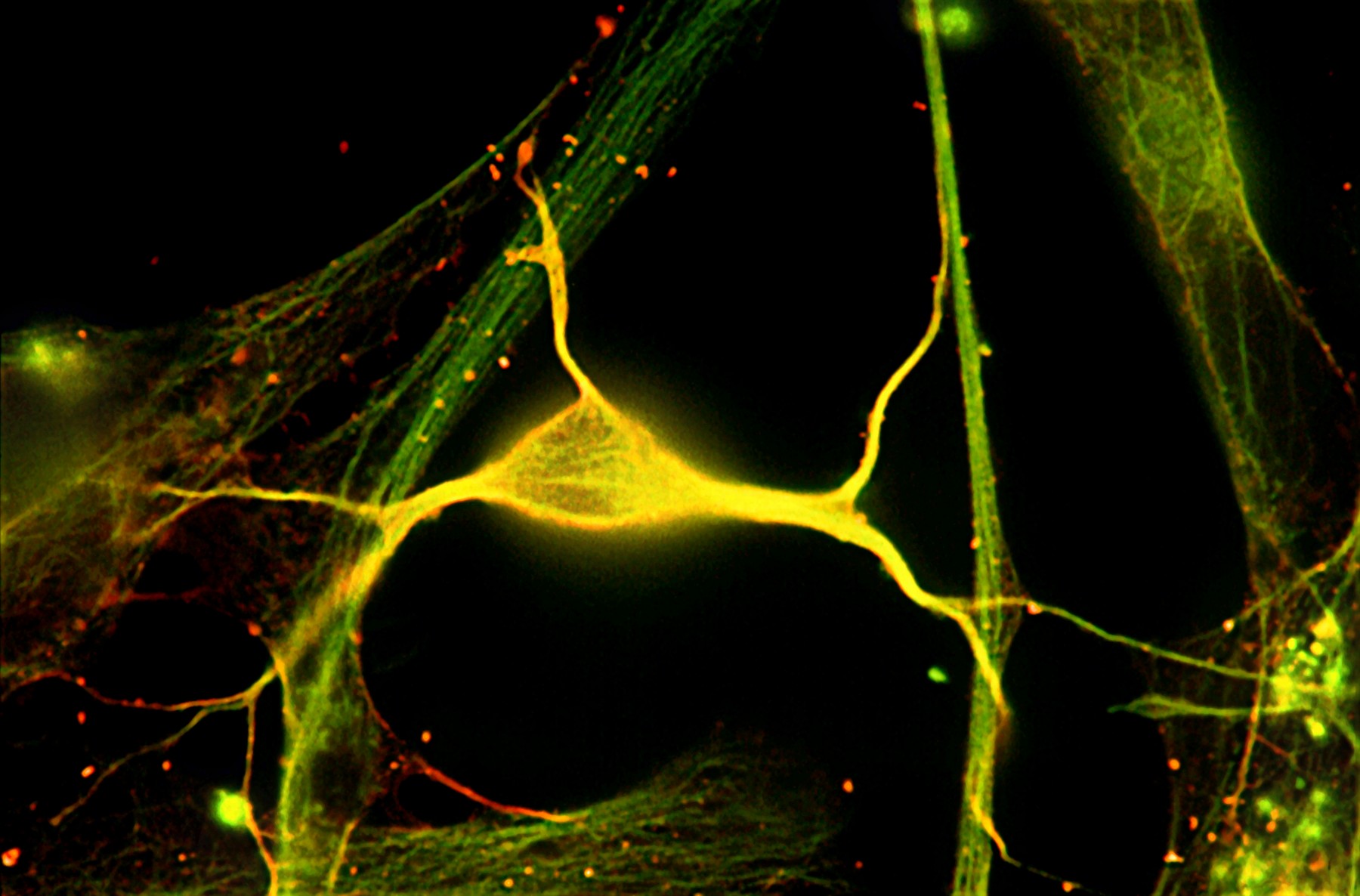 Клетки мозга восстанавливаются. Нейроны гиппокампа. Восстановление нейронов. Нейроны микрофото. Регенерация нейронов в гиппокампе.