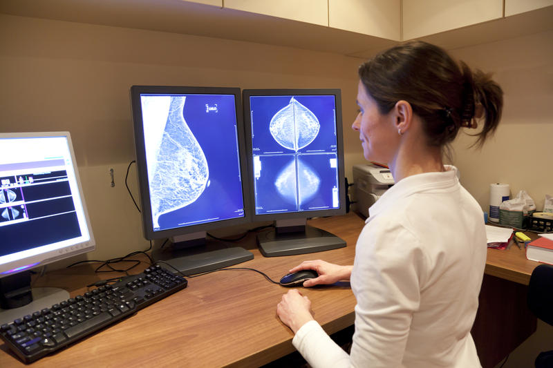 Cancerul de san si prevenirea lui