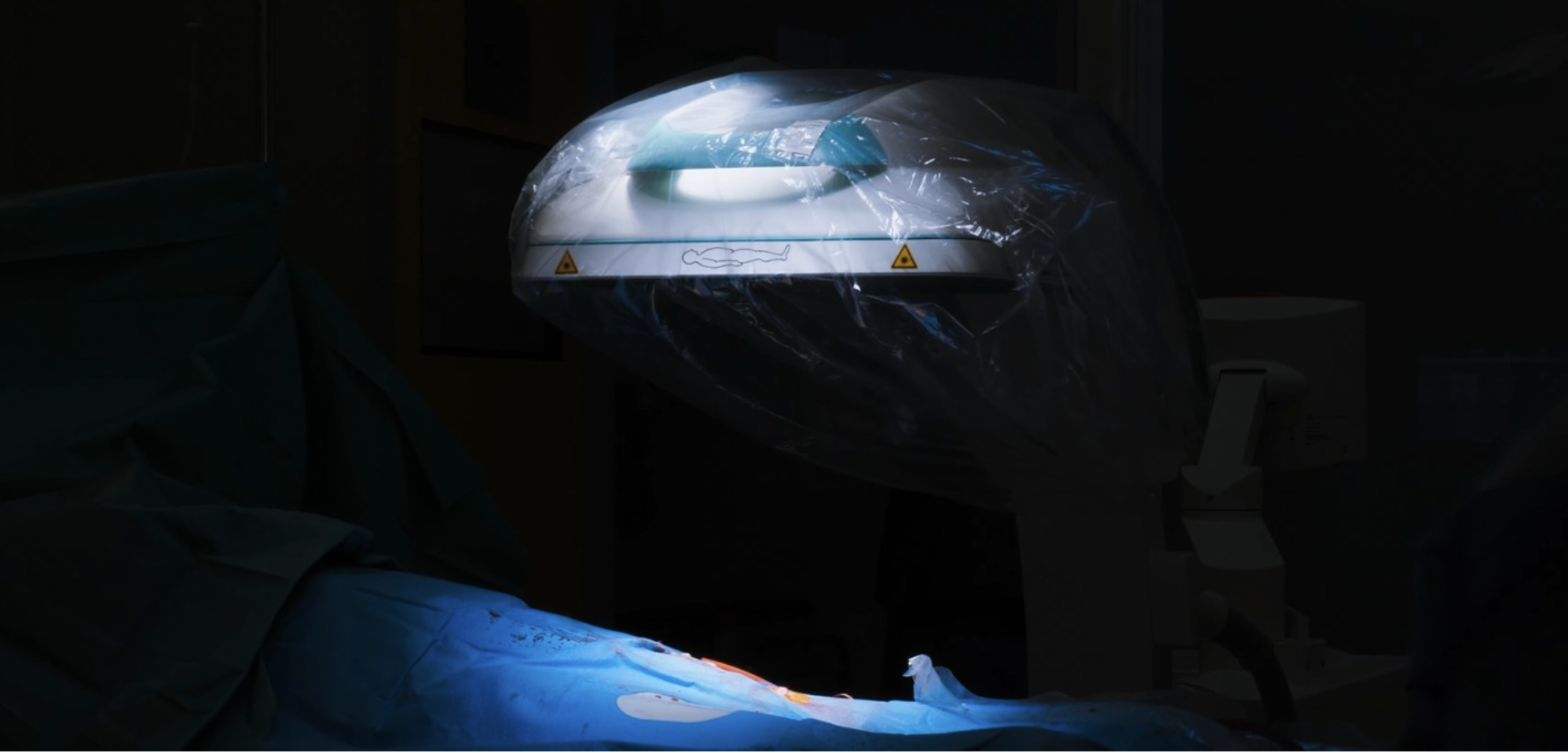 VIDEO Operație complexă de chirurgie vasculară în prima sală hibridă mobilă din Transilvania, la Spitalul MedLife Brașov