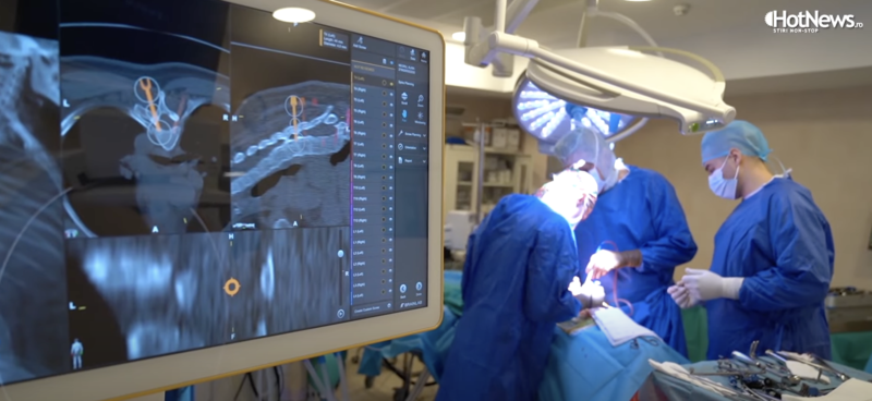 Ce poate face cea mai modernă tehnologie neurochirugicală din lume într-o sală de operație?