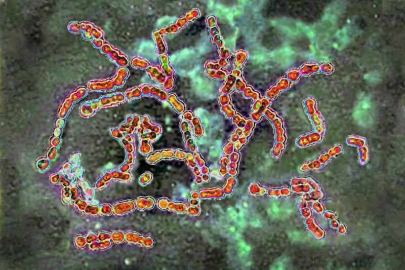 Bacterii Streptococcus pyogenes vazute la microscop